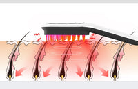 Electric Scalp Massager & Hair Growth Comb with Red & Blue Light Therapy